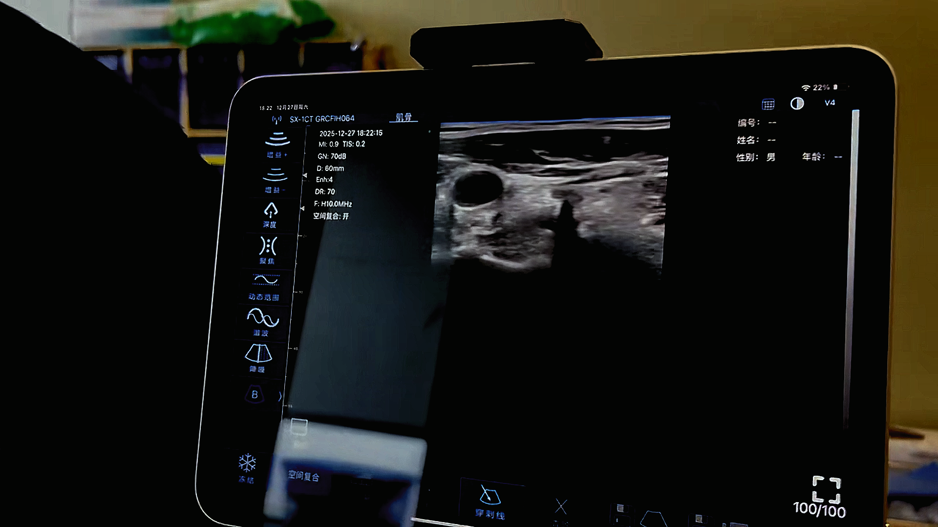 wndweb/uploads/20260112/17682039595278457.png 配图1.png